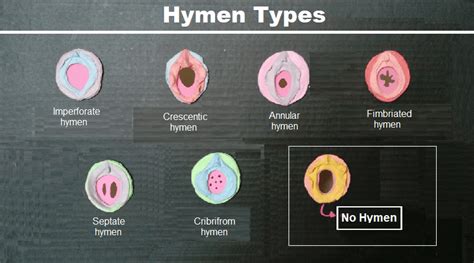 hymen photo|What Is the Hymen: Anatomy, Functions, Types and Care